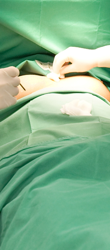 Borstverkleining België - Plastische Chirurgie Doctor Dombard.