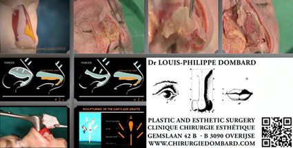 Neuscorrectie Master cursus DR L-Ph. Dombard