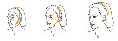Lifting du visage cervico-facial