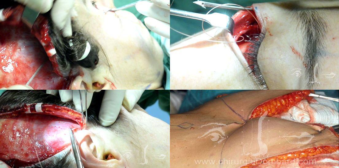 Spécialiste chirurgien esthétique chirurgien plasticien Overijse Bruxelles - DR L-Ph Dombard