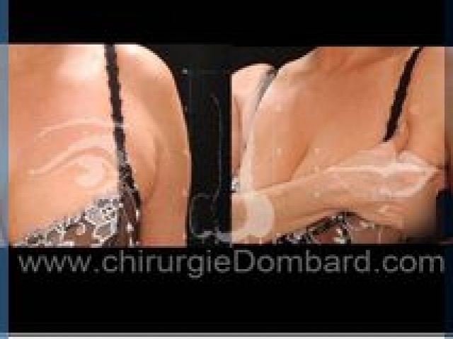 Liposculpture (liposuccion) axillaire et paroi latérale des seins - DR Dombard Bruxelles Belgique
