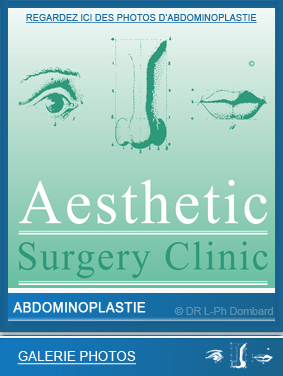 Vidéos chirurgie esthétique Abdominoplastie