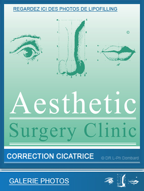 lipofilling-correction-cicatrice