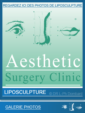liposculpture-liposuccion